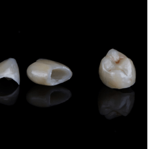 Dental Crowns