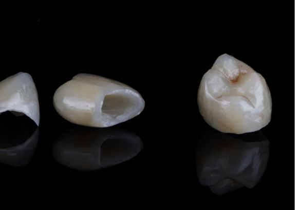 Dental Crowns