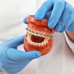 Orthodontic Treatment