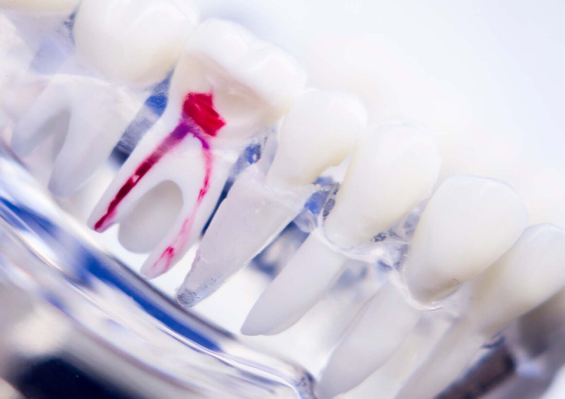 Services Nairobi Sterling Dental Clinic 0762 223 925