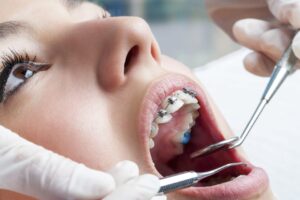 orthodontic treatment 