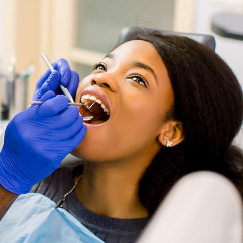 Dental Filling Dental Filling