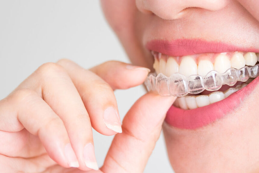 Simbaligner Simbaligner