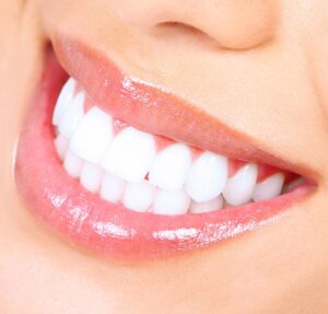 teeth whitening 