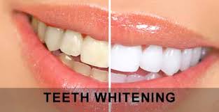 teeth whitening teeth whitening
