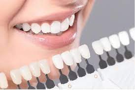 cosmetic dentistry: veneers 