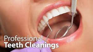 Teeth Cleaning services