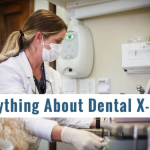 What Is a Dental X-Ray? Here's What You Need to Know
