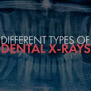Essential Dental X-Rays:
