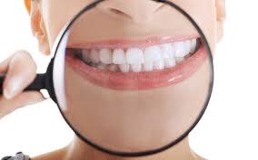 Top 5 Teeth Whitening Habits to Consider