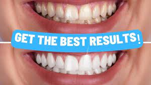 Top Ten Habits for Optimal Oral Hygiene
