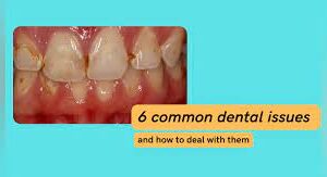 6 Common Dental Issues and How to Fix Them