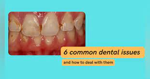 6 Common Dental Issues and How to Fix Them