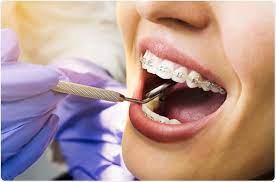 Best Dental Clinic in Nairobi CBD