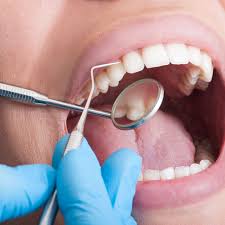 Dental Crowns Are a Secret of Hollywood Stars If You Ask The Correct Dentist: Getting Dental Crowns and the Benefits