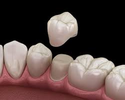 Discovering Quality Dental Care at Nairobi Sterling Dental Clinic