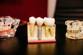 Top 10 Dental Clinics in Nairobi