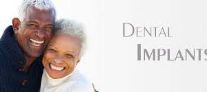 Choosing the Right Tooth Implants Dentist