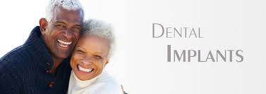 Choosing the Right Tooth Implants Dentist