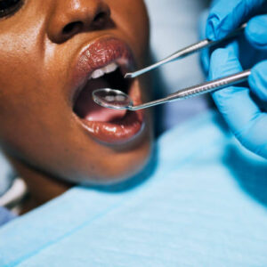 The Importance of Teeth Cleaning and Costs