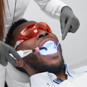 Professional Teeth Whitening Cost