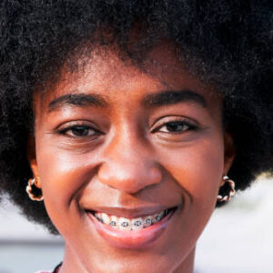 Does Having Braces Change Your Voice?