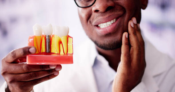 How Long Do Dental Implants Last? How Long Do Dental Implants Last?