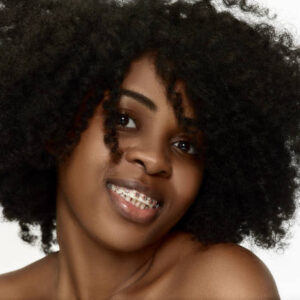 How Much Do Braces Cost in Nairobi, Kenya?