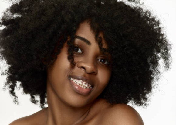 How Much Do Braces Cost in Nairobi, Kenya?