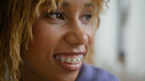Cost of Dental Braces in Nairobi: What to Expect in 2025