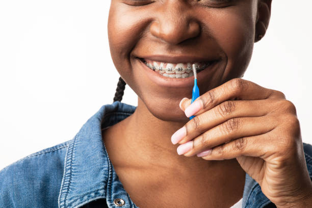 Types of Braces Available in Nairobi: Which One is Right for You?